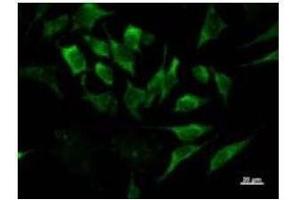 Immunostaining analysis in HeLa cells. (IRF3 antibody)