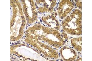 Immunohistochemistry of paraffin-embedded Human kidney using PSEN2 Polyclonal Antibody at dilution of 1:100 (40x lens). (Presenilin 2 antibody)