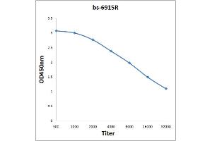 Antigen: 0. (AUTS2 antibody  (AA 845-945))