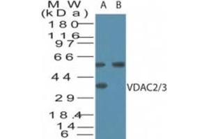 Image no. 1 for anti-Voltage-Dependent Anion Channel 2/3 (VDAC2/3) (AA 120-132) antibody (ABIN960406)
