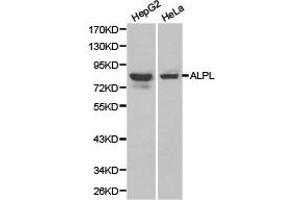 Western Blotting (WB) image for anti-Alkaline Phosphatase, Liver/bone/kidney (ALPL) antibody (ABIN1870948) (ALPL antibody)