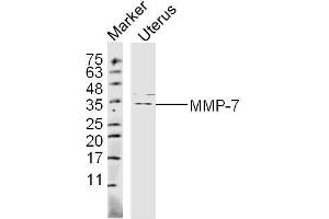 Mouse Uterus lysates probed with MMP-7 Polyclonal Antibody, unconjugated  at 1:300 overnight at 4°C followed by a conjugated secondary antibody at 1:10000 for 60 minutes at 37°C. (MMP7 antibody  (AA 151-250))