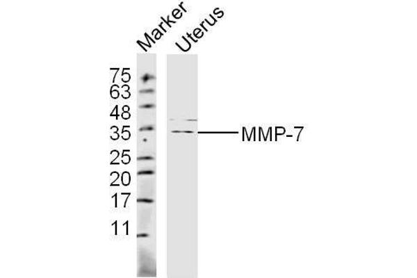 MMP7 抗体  (AA 151-250)