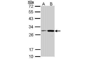 WB Image Sample (30 ug of whole cell lysate) A: Molt-4 , B: Raji 12% SDS PAGE antibody diluted at 1:1000