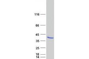 Validation with Western Blot