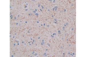 IHC-P analysis of brain tissue, with DAB staining. (GHRHR antibody  (AA 23-130))