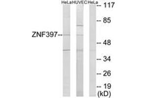 Western Blotting (WB) image for anti-Zinc Finger Protein 397 (ZNF397) (AA 10-59) antibody (ABIN2889680) (ZNF397 antibody  (AA 10-59))