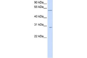 WB Suggested Anti-PNPLA4 Antibody Titration:  0. (PNPLA4 antibody  (C-Term))