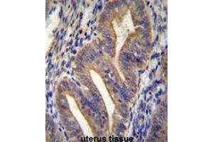 METTL10 Antibody (N-term) immunohistochemistry analysis in formalin fixed and paraffin embedded human uterus tissue followed by peroxidase conjugation of the secondary antibody and DAB staining. (METTL10 antibody  (N-Term))
