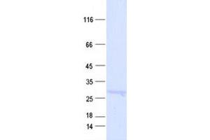 Validation with Western Blot