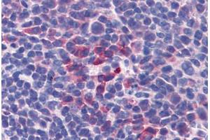 Mouse Spleen: Formalin-Fixed, Paraffin-Embedded (FFPE) (IL-10 antibody)