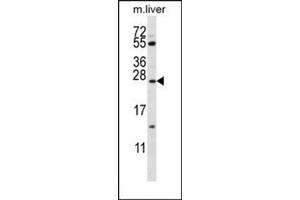 Western blot analysis using SFTPC Antibody (N-term) Cat. (Surfactant Protein C antibody  (N-Term))