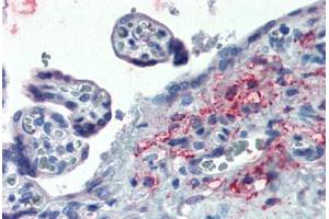 Placenta: Formalin-Fixed, Paraffin-Embedded (FFPE) (ERP44 antibody  (Internal Region))
