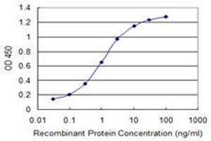 Detection limit for recombinant GST tagged MACF1 is 0. (MACF1 antibody  (AA 1-95))
