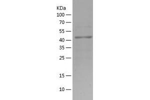 Western Blotting (WB) image for K(lysine) Acetyltransferase 2B (KAT2B) (AA 636-832) protein (His-IF2DI Tag) (ABIN7123657) (KAT2B Protein (AA 636-832) (His-IF2DI Tag))