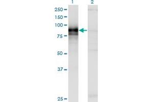 Western Blotting (WB) image for anti-Hedgehog Interacting Protein (HHIP) (AA 21-121) antibody (ABIN466235) (HHIP antibody  (AA 21-121))