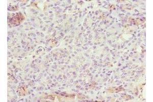 Immunohistochemistry of paraffin-embedded human pancreatic tissue using ABIN7151902 at dilution of 1:100 (EPS15L1 antibody  (AA 585-864))