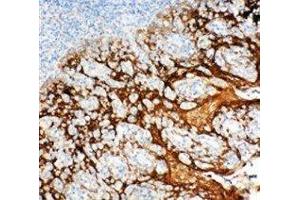 Anti-14-3-3 sigma antibody, IHC(P) IHC(P): Human Tonsil Tissue (14-3-3 sigma/SFN antibody  (Middle Region))