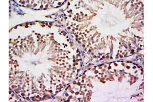Paraformaldehyde-fixed, paraffin embedded mouse testis tissue, Antigen retrieval by boiling in sodium citrate buffer(pH6) for 15min, Block endogenous peroxidase by 3% hydrogen peroxide for 30 minutes, Blocking buffer (normal goat serum) at 37°C for 20min, Antibody incubation with Rabbit Anti-NEK9 Polyclonal Antibody, Unconjugated  at 1:500 overnight at 4°C, followed by a conjugated secondary and DAB staining (NEK9 antibody)