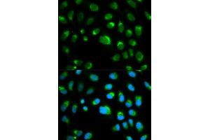 Immunofluorescence analysis of HeLa cell using TLR1 antibody. (TLR1 antibody  (AA 30-290))