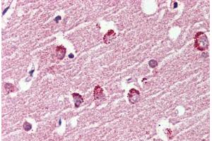 Anti-GPR119 antibody  ABIN1048698 IHC staining of human brain, cortex.