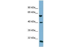 Host:  Rabbit  Target Name:  SLC2A10  Sample Type:  NCI-H226 Whole Cell lysates  Antibody Dilution:  1. (SLC2A10 antibody  (C-Term))