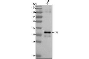Western blot analysis of ACP5 using anti-ACP5 antibody (ABIN7606567).