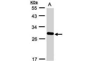 WB Image Sample(30 ug whole cell lysate) A:A431, 12% SDS PAGE antibody diluted at 1:1000 (YIPF4 antibody)