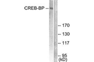 Western blot analysis of extracts from HeLa cells, treated with Insulin 0. (CBP antibody  (AA 2393-2442))