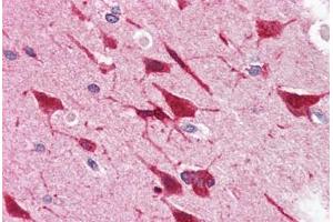 Human Brain, Cortex (formalin-fixed, paraffin-embedded) stained with GRB2 antibody ABIN364459 at 5 ug/ml followed by biotinylated anti-mouse IgG secondary antibody ABIN481714, alkaline phosphatase-streptavidin and chromogen. (GRB2 antibody)
