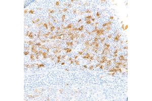 Immunohistochemistry (IHC) image for anti-Indoleamine 2,3-Dioxygenase 1 (IDO1) (AA 1-403) antibody (ABIN7449541) (Recombinant IDO1 antibody  (AA 1-403))