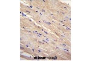FB Antibody (N-term) (ABIN655226 and ABIN2844832) immunohistochemistry analysis in formalin fixed and paraffin embedded human m. (FAM69B antibody  (N-Term))