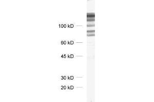 dilution: 1 : 1000, sample: crude synaptosomal fraction of rat brain (P2) (DLG1 antibody)