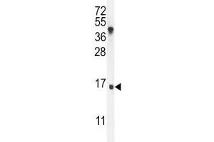 IGKV antibody western blot analysis in MDA-MB435 lysate. (IGKV A18 antibody  (AA 80-107))