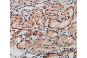 Used in DAB staining on fromalin fixed paraffin- embedded kidney tissue (KRT9 antibody  (AA 315-456))