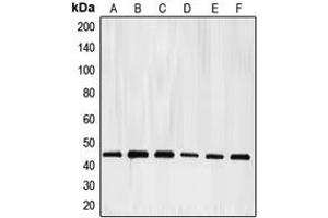 Western blot analysis of E2F4 expression in HeLa (A), K562 (B), Jurkat (C), Raji (D), A431 (E), mouse kidney (F) whole cell lysates. (E2F4 antibody  (Center))
