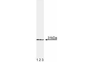Western blot analysis of DsRed. (RFP antibody)