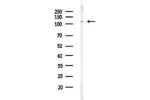 anti-ADAM Metallopeptidase Domain 17 (ADAM17) (pThr735) antibody