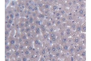 #VALUE! (AGXT2 antibody  (AA 226-513))