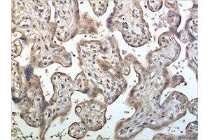 Immunohistochemistry (IHC) image for anti-ADAM Metallopeptidase Domain 10 (ADAM10) (AA 214-672) antibody (ABIN1982991) (ADAM10 antibody  (AA 214-672))