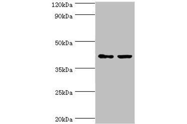 GTF2H2C antibody  (AA 1-260)
