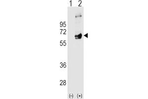 Western Blotting (WB) image for anti-FYN Oncogene Related To SRC, FGR, YES (FYN) antibody (ABIN3003445) (FYN antibody)