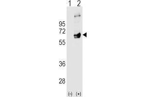 Western Blotting (WB) image for anti-FYN Oncogene Related To SRC, FGR, YES (FYN) antibody (ABIN3003445)