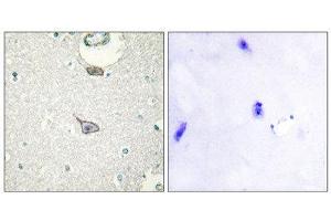 Immunohistochemistry (IHC) image for anti-Cell Adhesion Molecule 4 (CADM4) (C-Term) antibody (ABIN1850236) (Cell Adhesion Molecule 4 antibody  (C-Term))