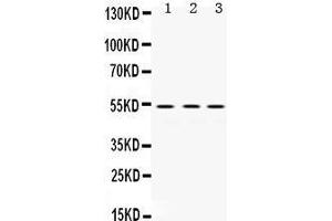 Western Blotting (WB) image for anti-Matrix Metallopeptidase 1 (Interstitial Collagenase) (MMP1) (AA 194-231), (Middle Region) antibody (ABIN3043405) (MMP1 antibody  (Middle Region))