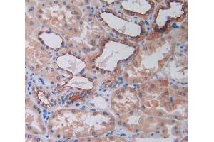 IHC-P analysis of kidney tissue, with DAB staining. (SLC12A3 antibody  (AA 3-146))