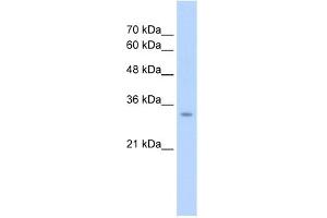 WB Suggested Antibody Titration:  2. (GLS2 antibody  (Middle Region))