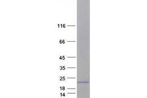 Validation with Western Blot (Midkine Protein (Transcript Variant 1) (Myc-DYKDDDDK Tag))