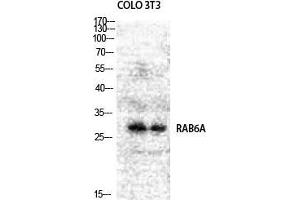 Western Blot (WB) analysis of COLO205 NIH-3T3 cells using Rab 6A Polyclonal Antibody.