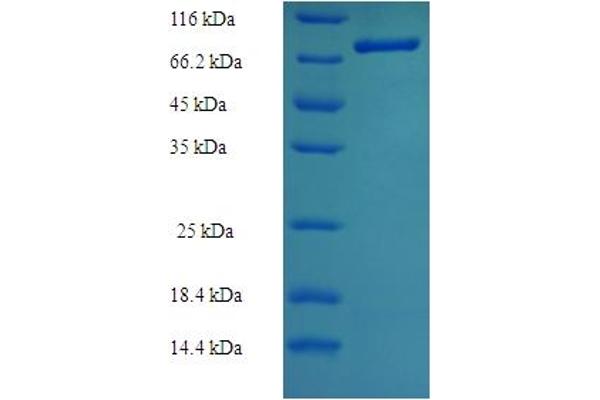 TXNRD2 Protein (AA 37-524) (His-SUMO Tag)